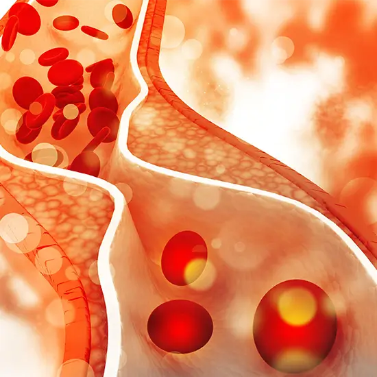 HDL Cholesterol Direct